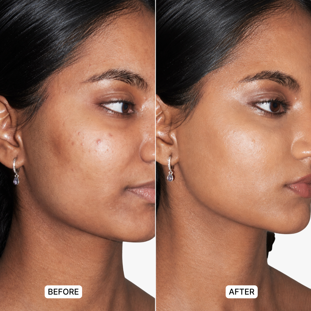 Wide Awake Eye Corrector